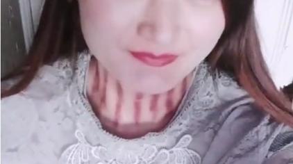 揪痧视频疼哭 西瓜视频