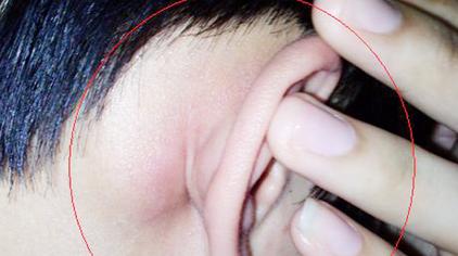 02:09营养师美真耳朵出现一个异常症状,代表4个身体问题,可别用手挤它