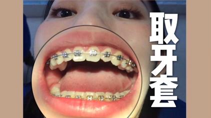 拔大牙矫正 西瓜视频