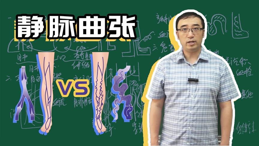 静脉曲张竟然引起大喷血？李永乐老师告诉你如何预防和治疗？