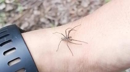 毒蜘蛛咬人怎么治疗 - 西瓜视频